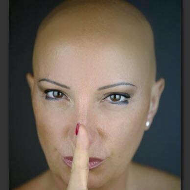 protesi per alopecia areata